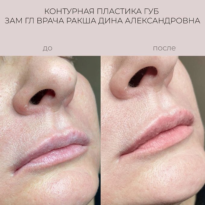 Фото процедуры 1