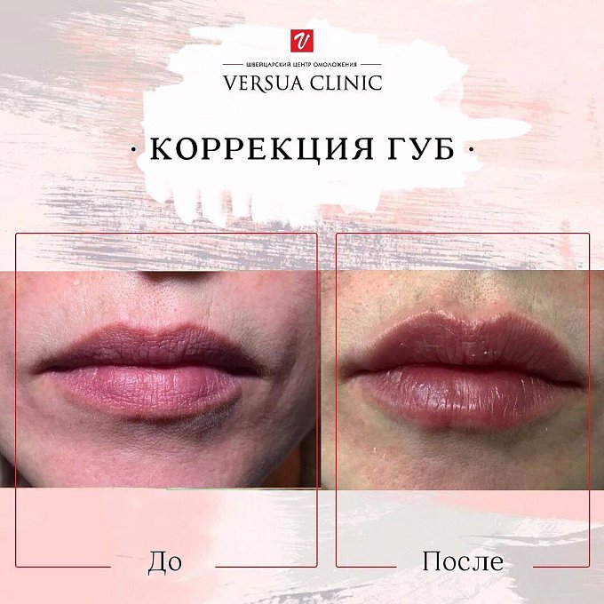 Фото процедуры 6