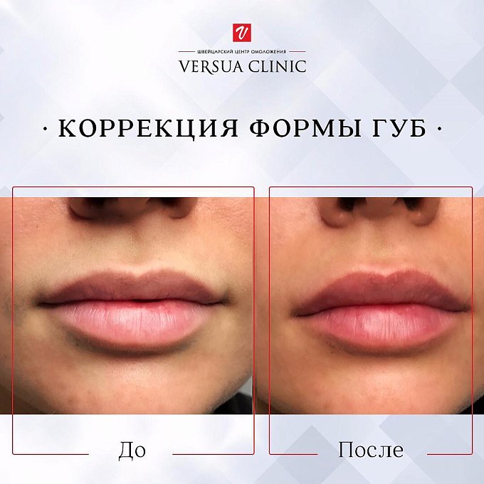 Фото процедуры 10