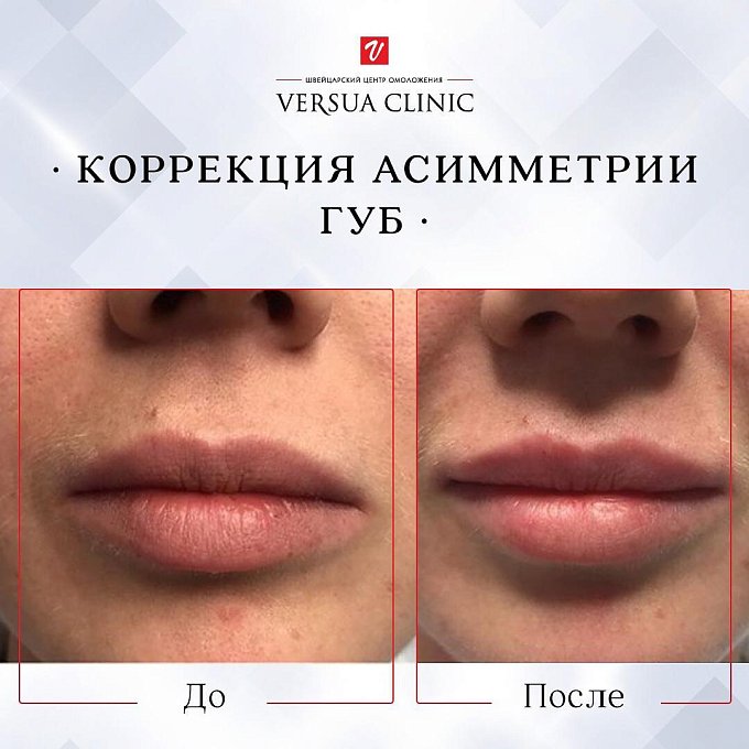 Фото процедуры 8
